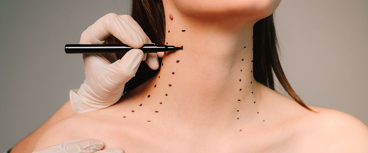 donna controllo pre operazione lifting collo Platisma